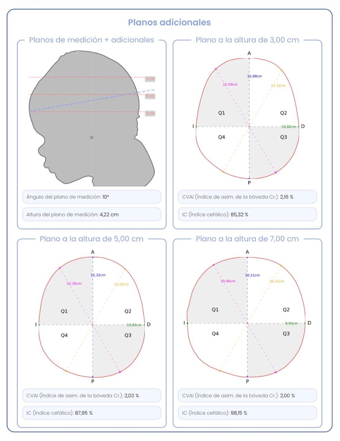 Planos de medição adicionais da avaliação craniana